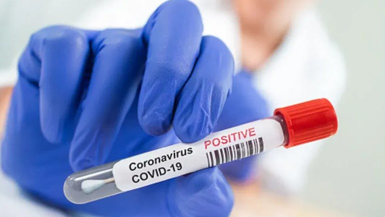 J&K Reports 85 Fresh Covid-19 Cases today, Active Tally Over 700