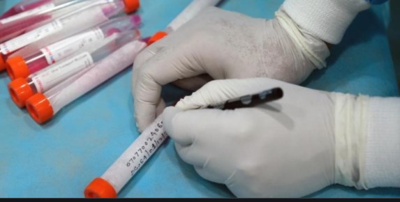 Health card based monthly RTPCR testing for high risk groups started in Udhampur
