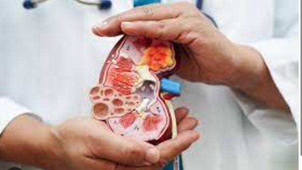 How to prevent chronic kidney disease? Expert explains causes, shares prevention tips
