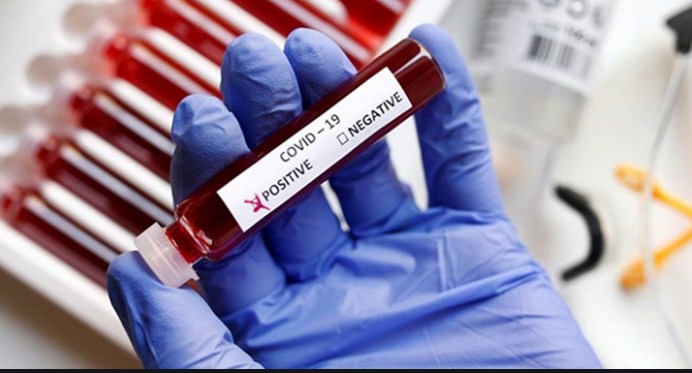 2 doctors, 17 para-medical staff members test positive at District Hospital Udhampur